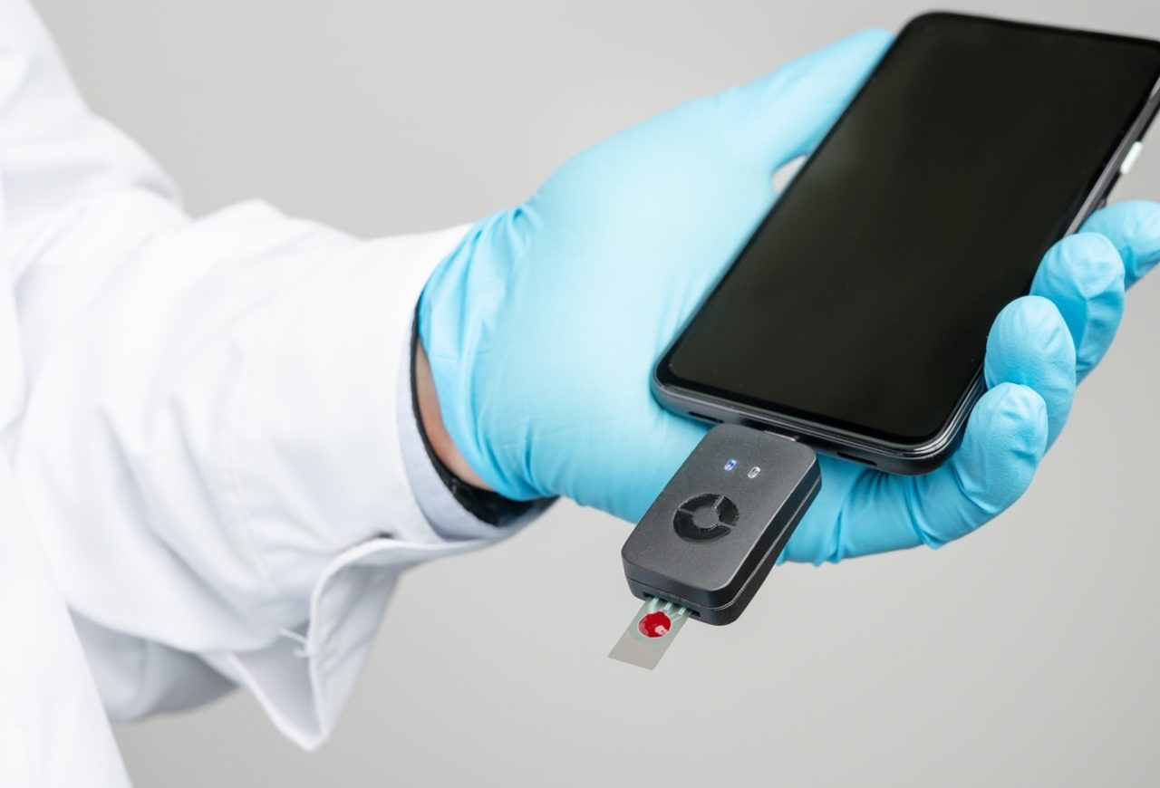 Electrochemical sensors for point of use diagnostics from Canatu